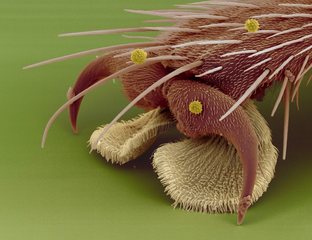 microscopic closeup of a fly's foot which is shades of light brown with lots of little hairs all over it against a green background