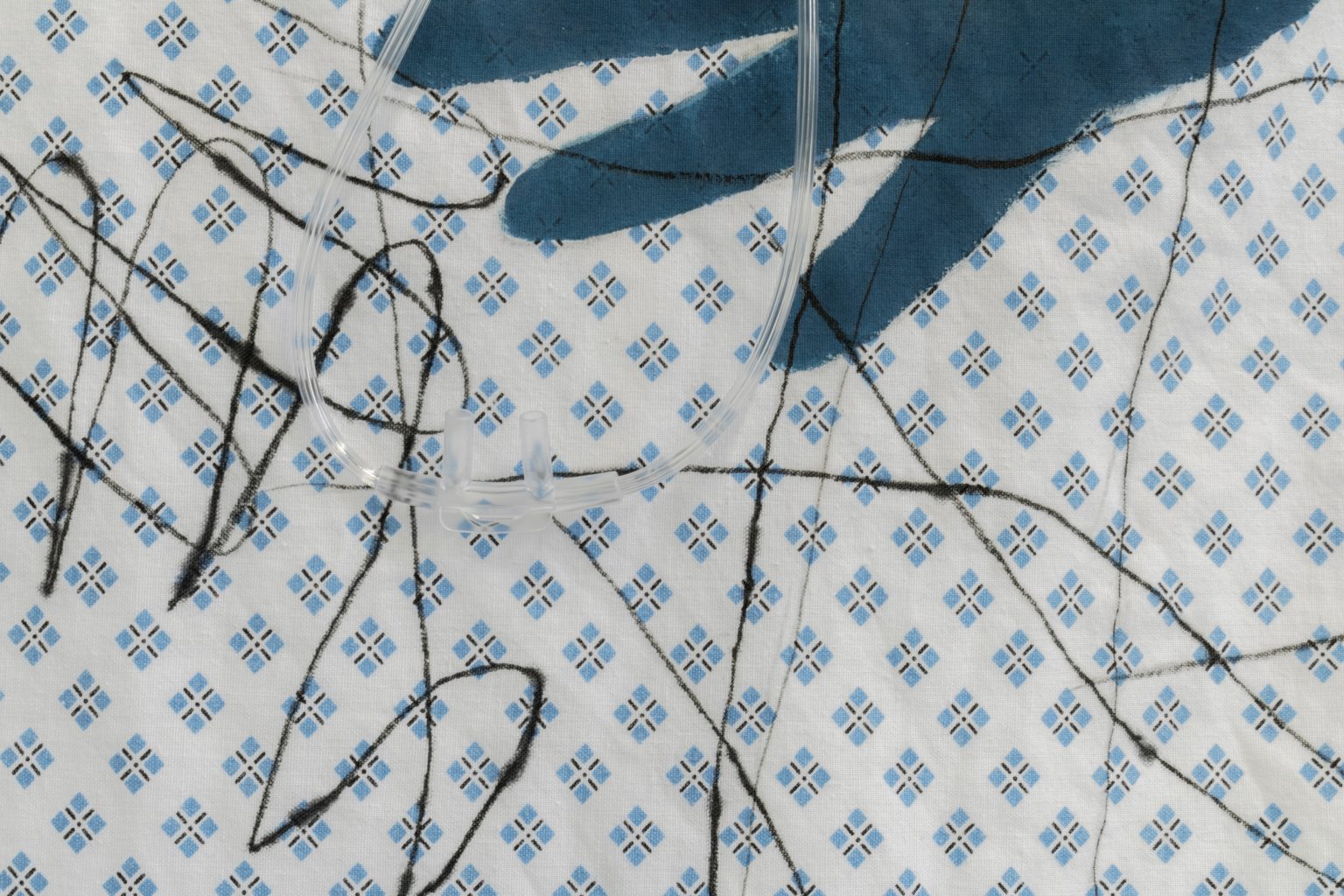 closeup of hospital gown material with dark outlines of crossed over fingers of hands drawn on