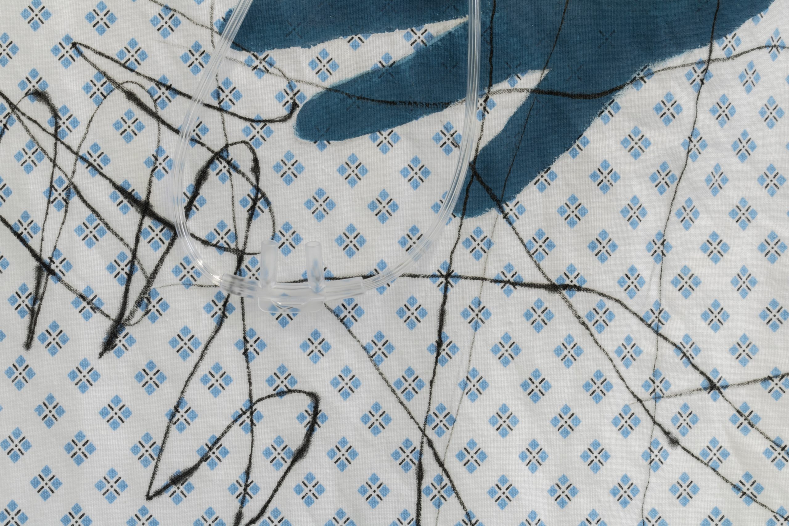 closeup of hospital gown material with dark outlines of crossed over fingers of hands drawn on